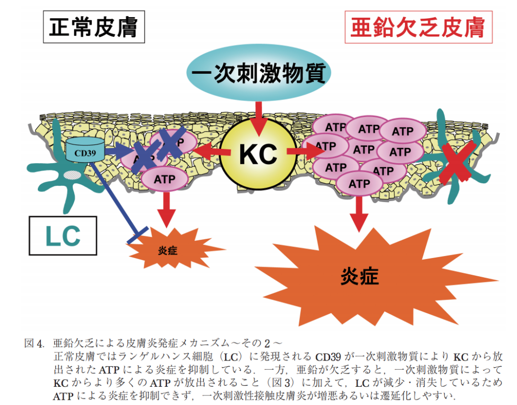 亜鉛欠乏による皮膚症状 爪症状 知ることと学ぶこと