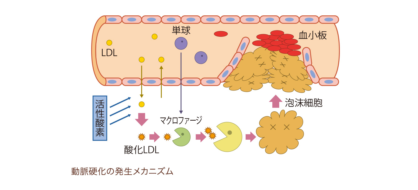 リポタンパク質と動脈硬化 知ることと学ぶこと
