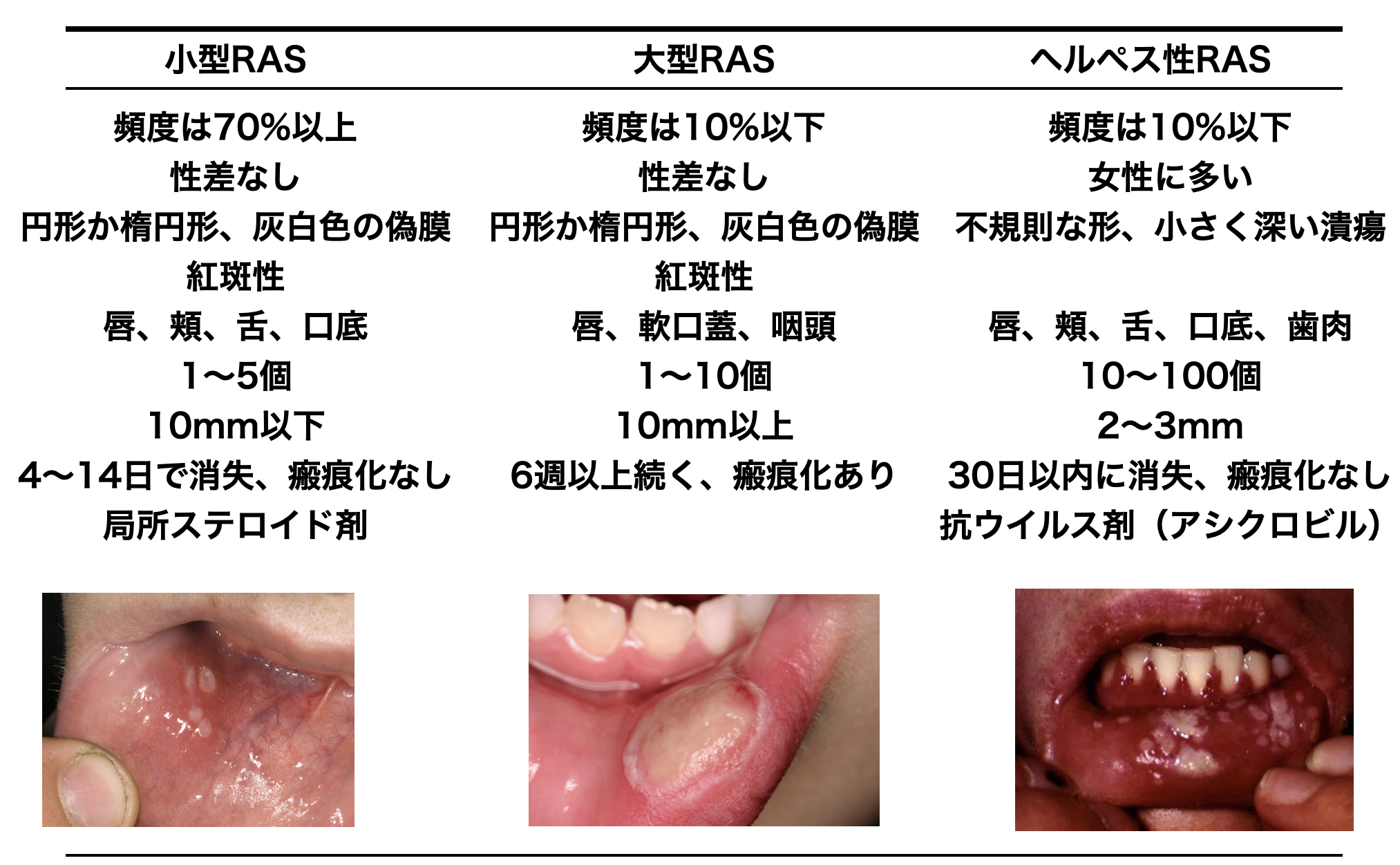 潰瘍からの回復