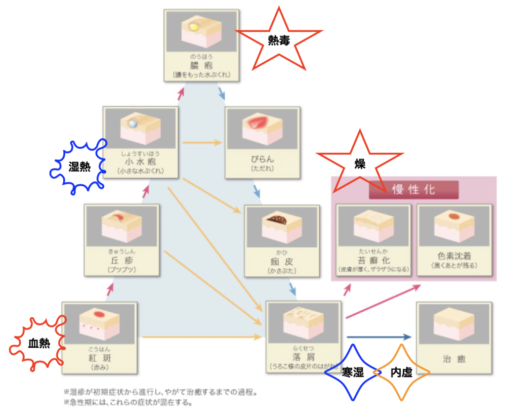 湿疹の中医治療 - 天王寺こいでクリニック 心療内科・神経内科・栄養療法・漢方内科